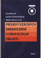 Projevy vzácných onemocnění v orofaciální oblasti  (odkaz v elektronickém katalogu)