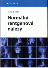 Normální rentgenové nálezy  (odkaz v elektronickém katalogu)