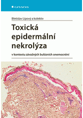 Toxická epidermální nekrolýza v kontextu závažných bulózních onemocnění  (odkaz v elektronickém katalogu)